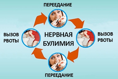 Лечение булимии в Брюховецкой